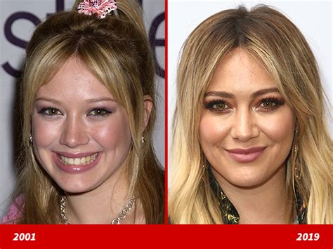 hillary duff plastic surgery|The Truth Behind Hilary Duff’s Plastic Surgery Rumors